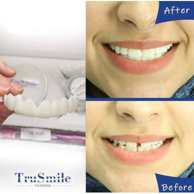 فروشگاه گجت پلاس3,270,000 ریاللمینت متحرک دندان TRUE SMILE(فَک بالا و فَک پایین) درجه کیفیت و سَختی:AAA+|لوازم زیبایی