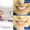 فروشگاه گجت پلاس3,270,000 ریاللمینت متحرک دندان TRUE SMILE(فَک بالا و فَک پایین) درجه کیفیت و سَختی:AAA+|لوازم زیبایی