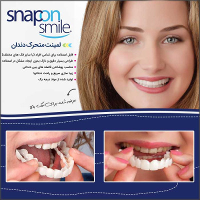 فروشگاه گجت پلاس2,290,000 ریاللمینت دندان فوری snap on  smile فَک بالا و فَک پایین(کیفیت سختی:AAA+)|خانه