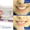 فروشگاه گجت پلاس1,870,000 ریاللمینت متحرک دندان TRUE SMILEدرجه کیفیت:AAA+|لوازم شخصی
